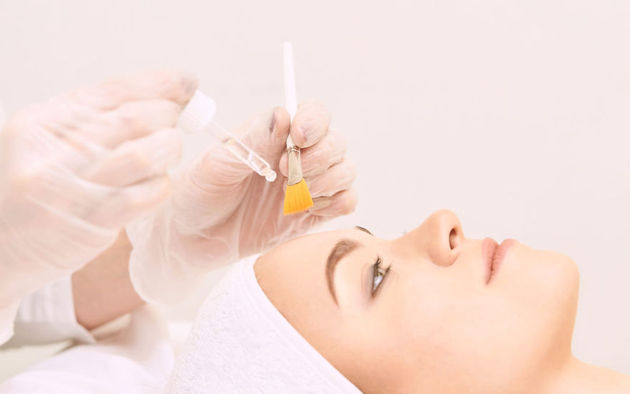 Chemical-Peel-1080x675.jpg