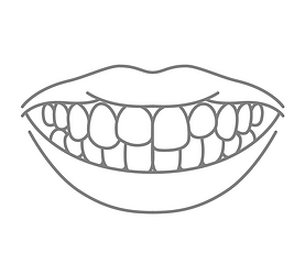 논현 라미네이트