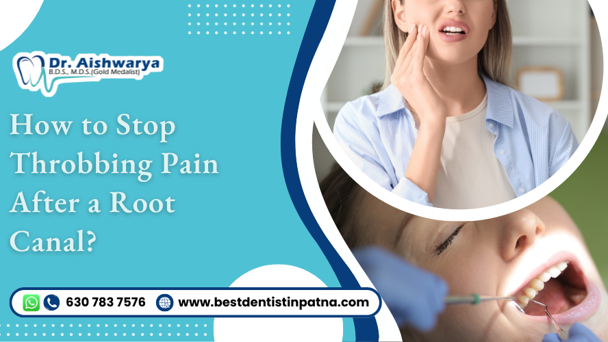 7 Ways to Prevent Throbbing Pain after a Root Canal Treatment
