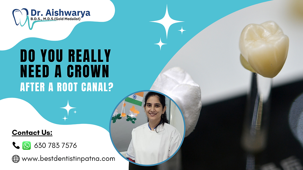 Do You Always Need a Crown after a Root Canal Treatment