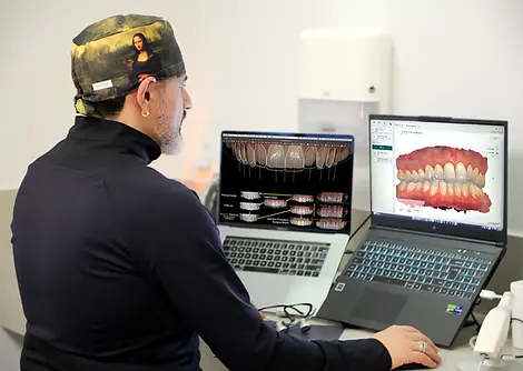 tecnologia-restauracao-dentes-resina-3D-campinas.webp