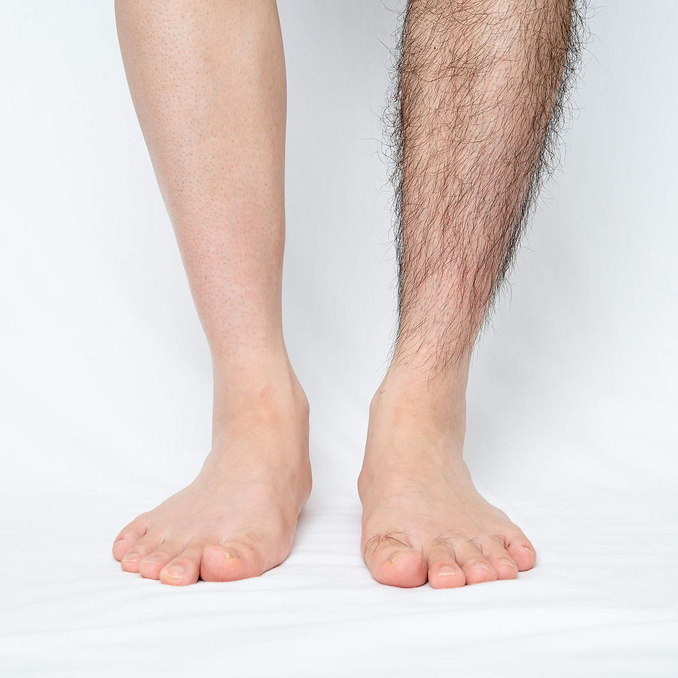 Thumbnail: Sugar Paste 32, Bikini Area Waxing Paste, Extreme Adhesive Effect, 400g