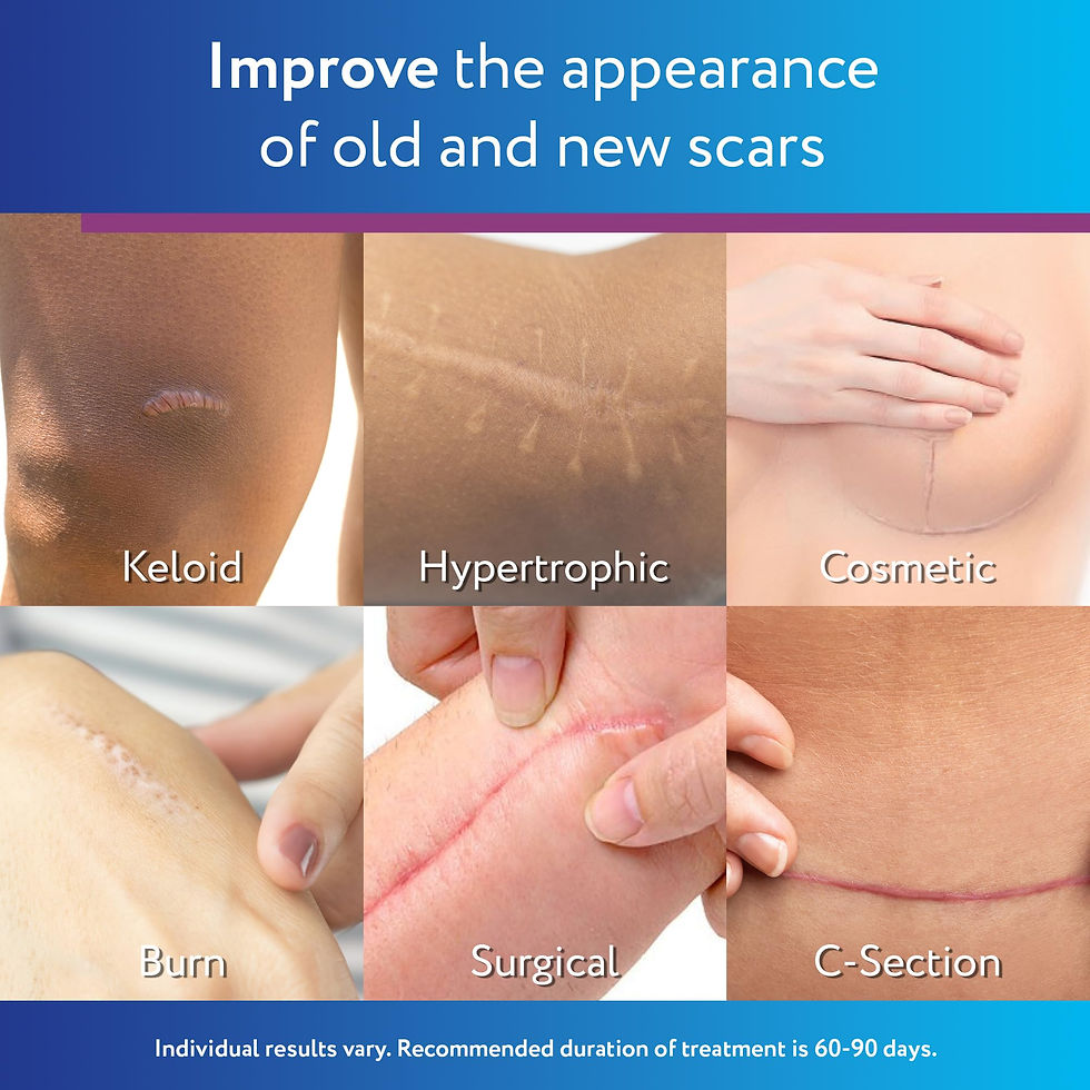 Thumbnail: ScarAway Silicone Scar Helps Size, Color & Gel, Improve from Texture of