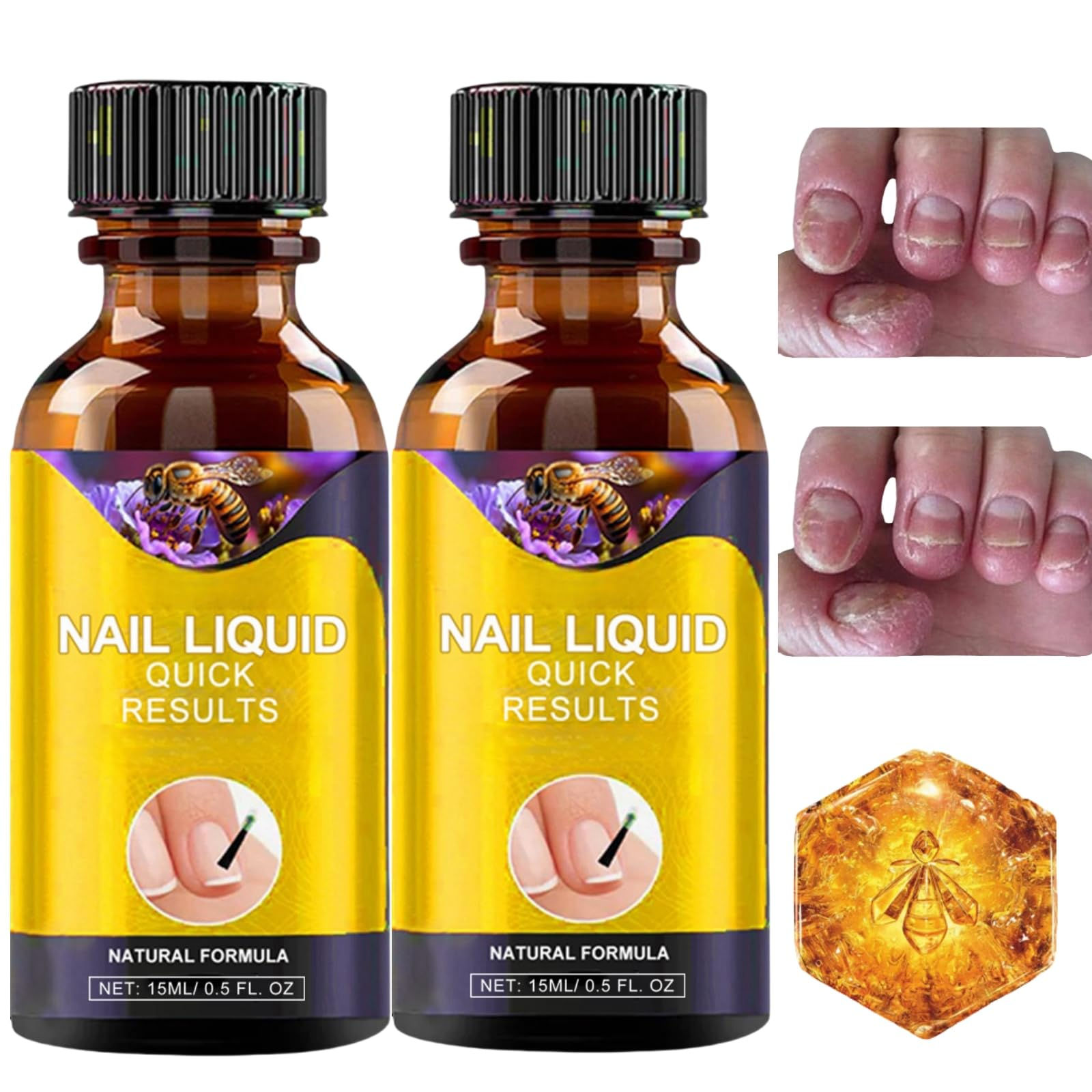 2PCS Bee Venom Nail Treatment Serum for Fungal Toenail Repair