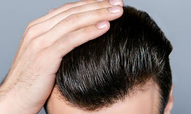 hair-restoration-content-photo.jpg