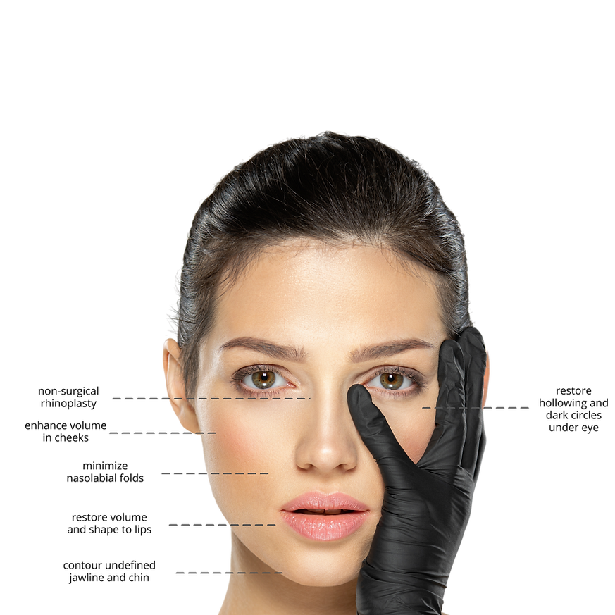 enhance volume in cheeks (2).png
