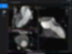 Notes for Sample Cardiac - CT - unnamed 4.jpeg