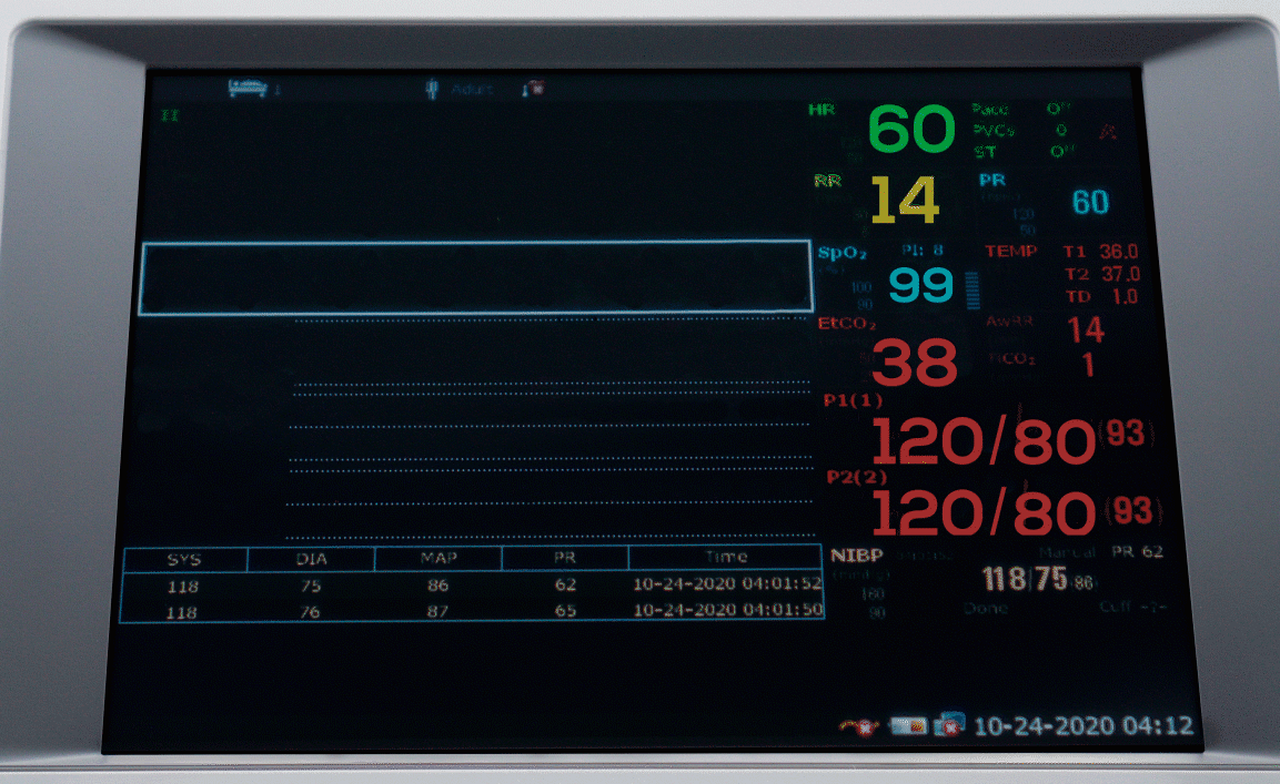 iM 60 Bedside Monitor