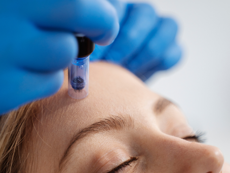 Close-up of a client receiving a professional microneedling treatment on the forehead, with a practitioner wearing blue medical gloves using a skin needling device. The Retreat Brecon in Brecon