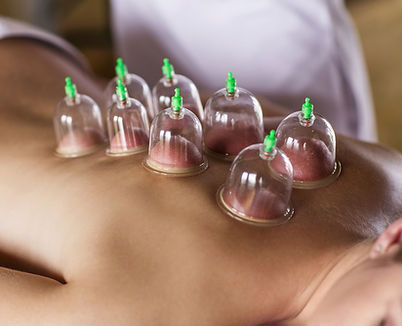 cupping.jpg