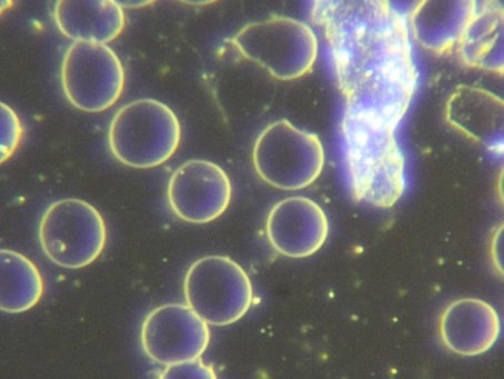 Common Questions Regarding Live Blood Analysis