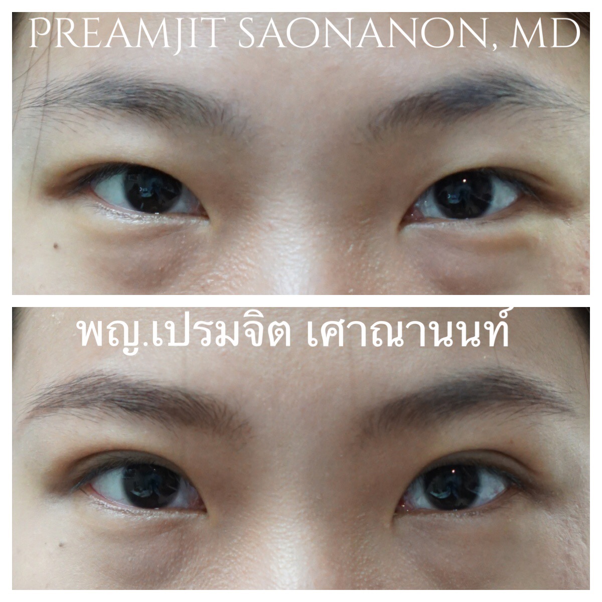 ทำตาสองชั้น