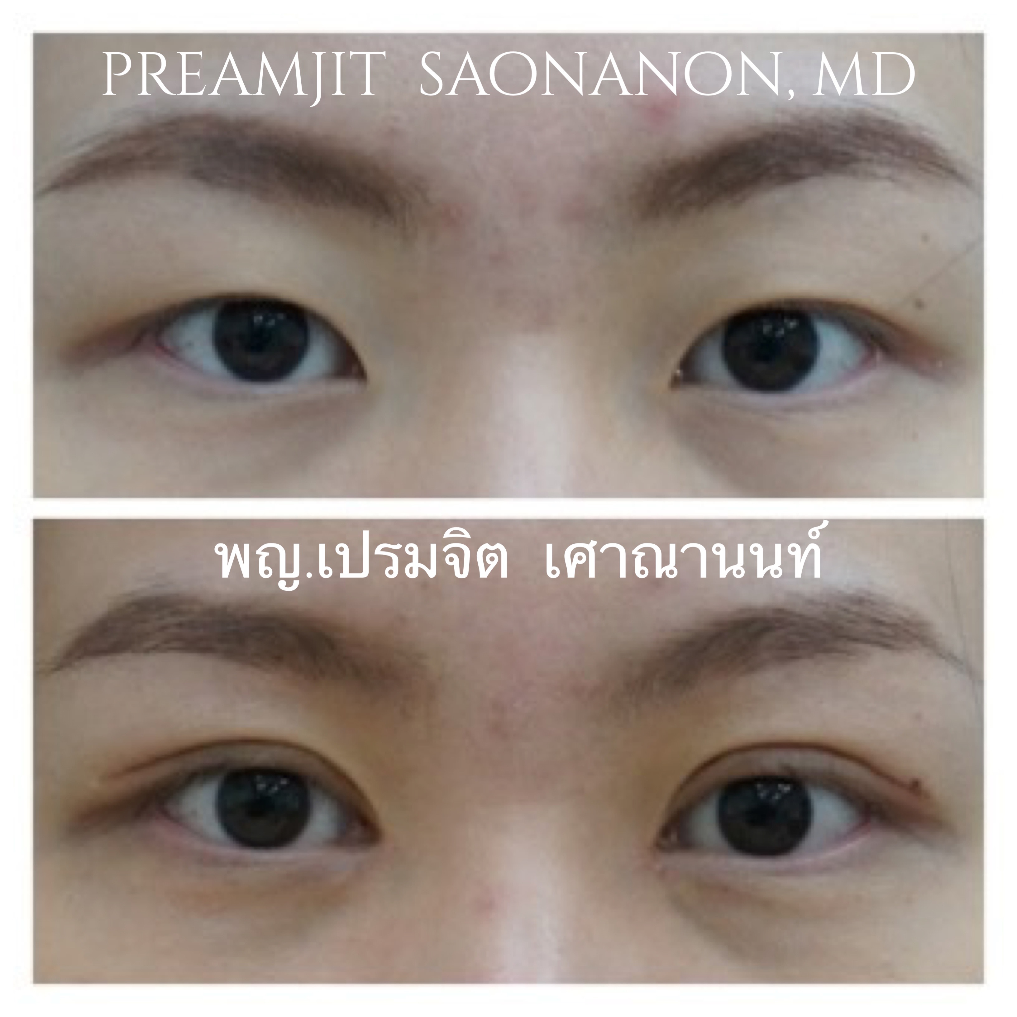 แก้ไขหนังเกินทำตาสองชั้น