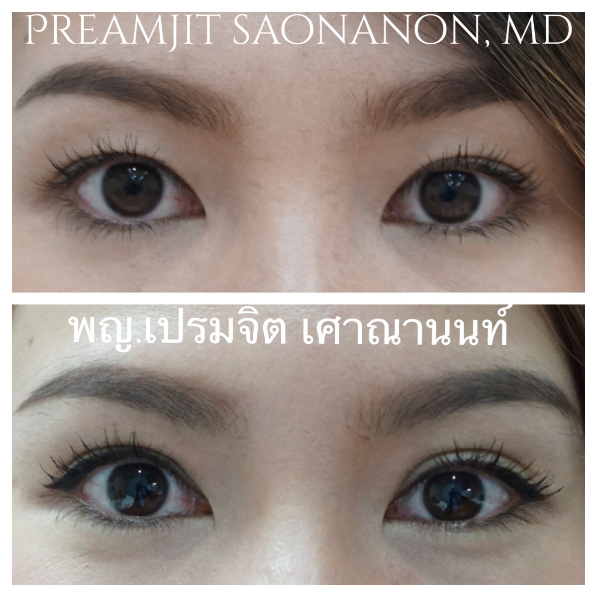 ทำตาสองชั้น