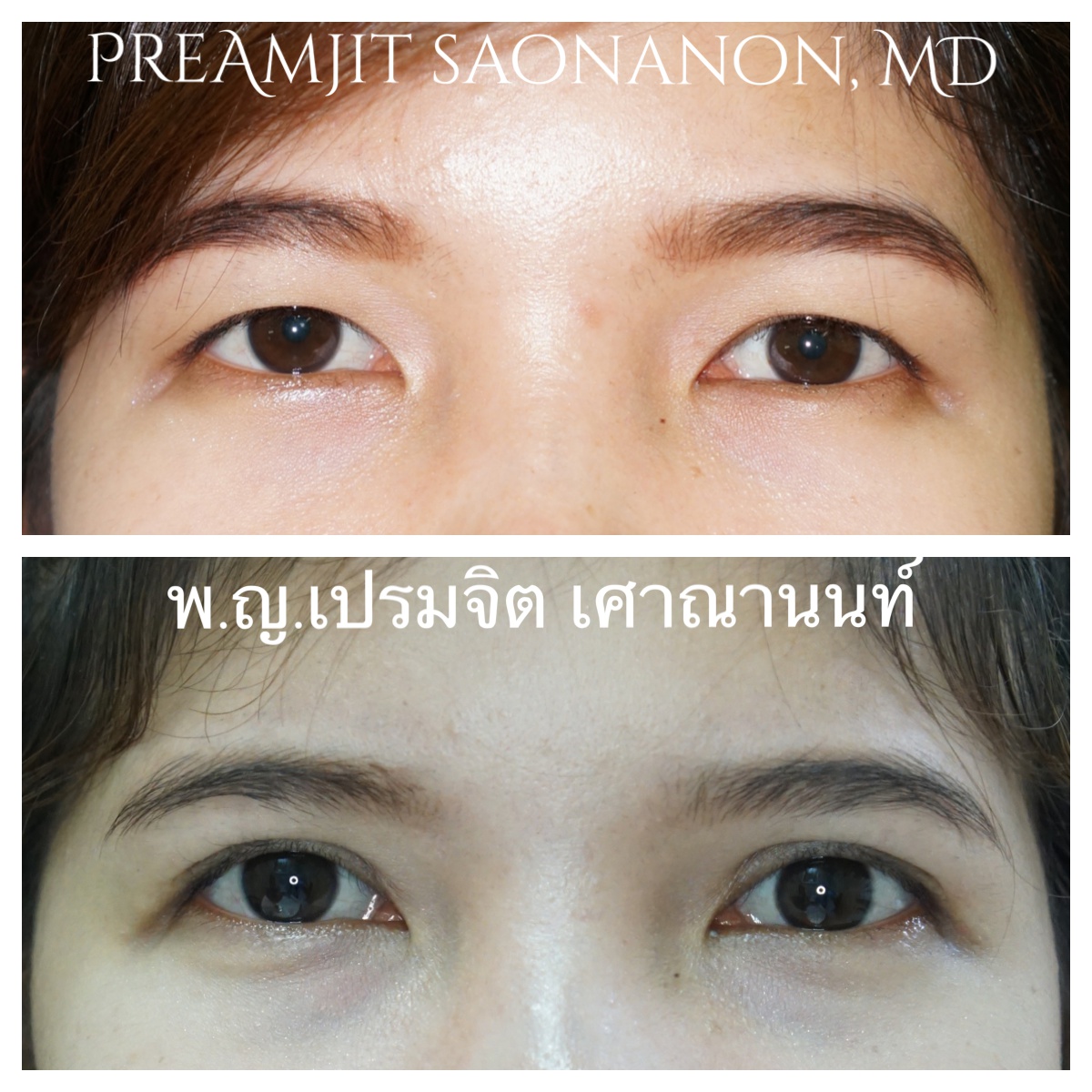 ทำตาสองชั้น