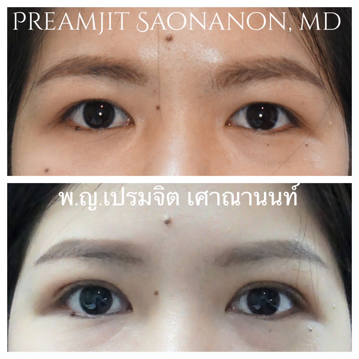 ทำตาสองชั้น