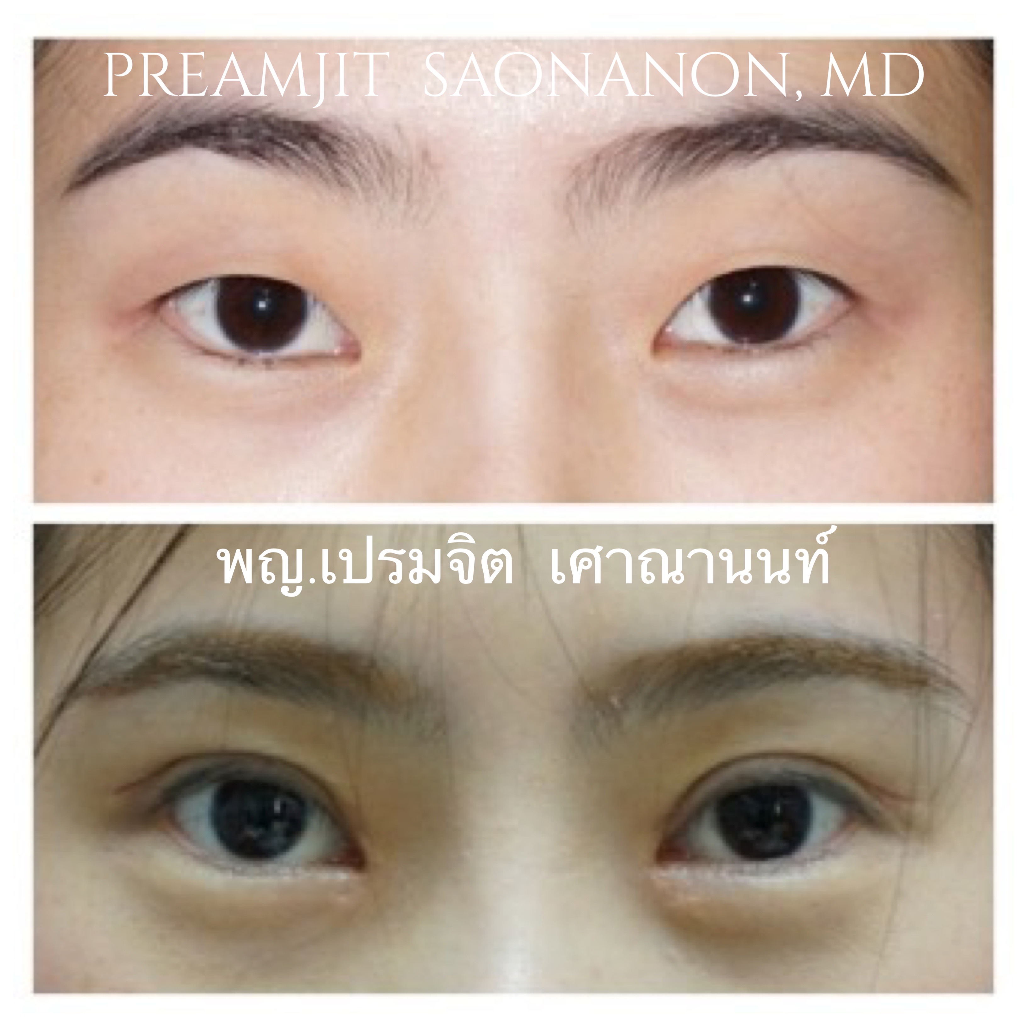 ทำตาสองชั้น
