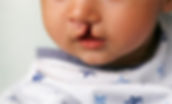 Fisioterapia respiratória
