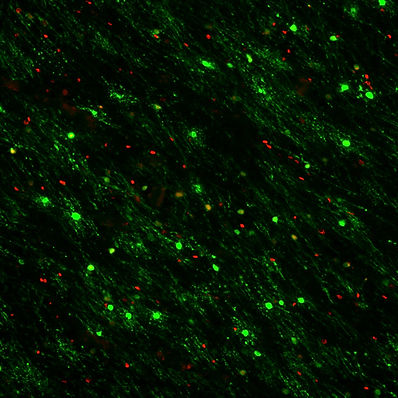 UCSF 0013 BCAS1 Olig2.jpg