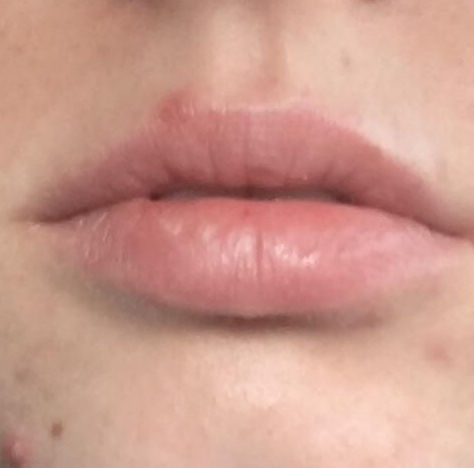 Sneaky Pore Clogging Makeup: Lip Liner Edition