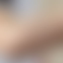 How To Finally Heal Bumpy Arms Etc