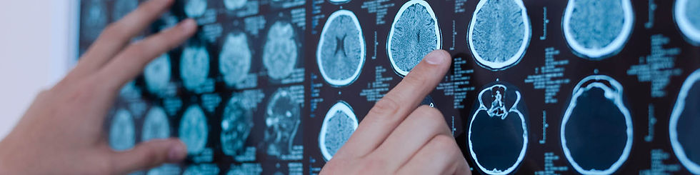 Neurologista em Curitiba; blog de neurologia