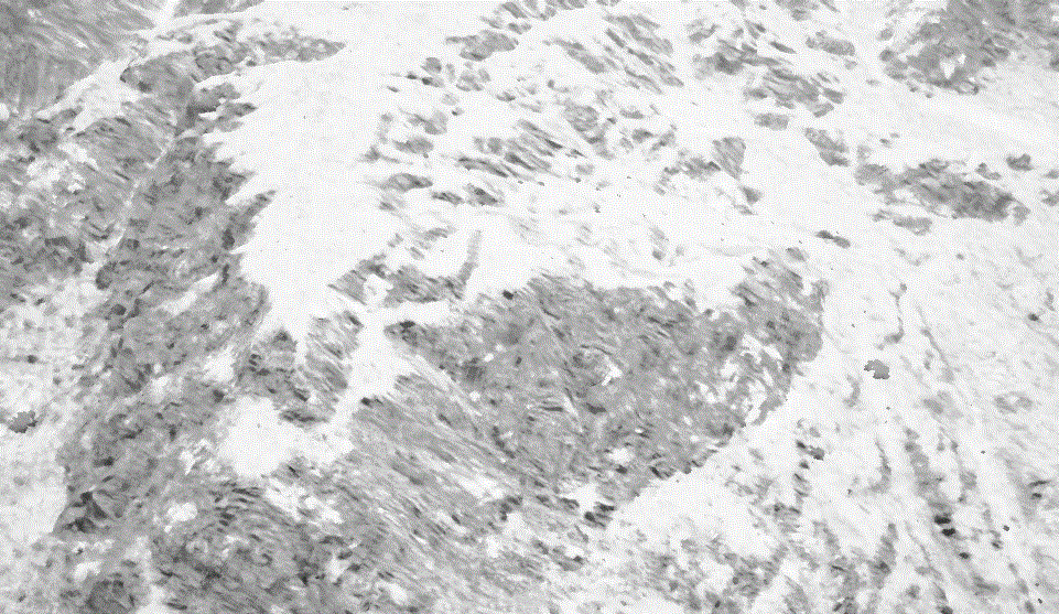Distortion.gif