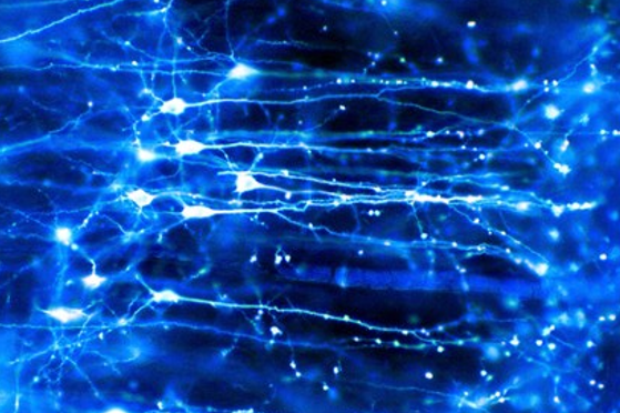Figure 8: The neural network in the brain (Extracted from Wellcome Collection by Dr Johnathan Clarke, 2025)