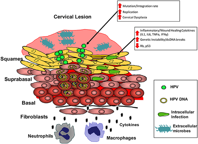 Embracing New Screening Methods for Cervical Cancer: Understanding the Path from HPV Infection to Early Detection and Prevention
