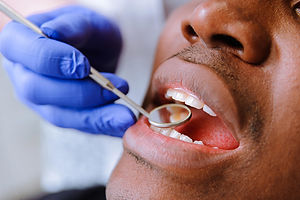 10_Dental_Surprising-Health-Benefits-Of-