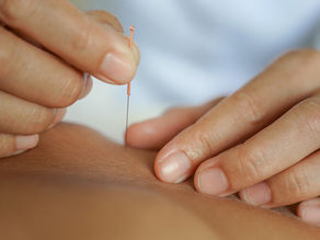 TERAPIE SUCHOU JEHLOU ČI AKUPUNKTURA?