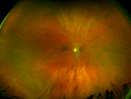 Retinal imaging used during a comprehensive eye exam at OPTISM in Tampa