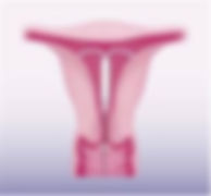 iud pic.jpg