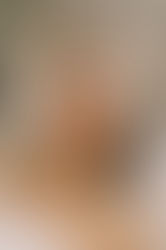 Advanced Skin & Hair Care in Mira Road | Newderma Aesthetic Clinic