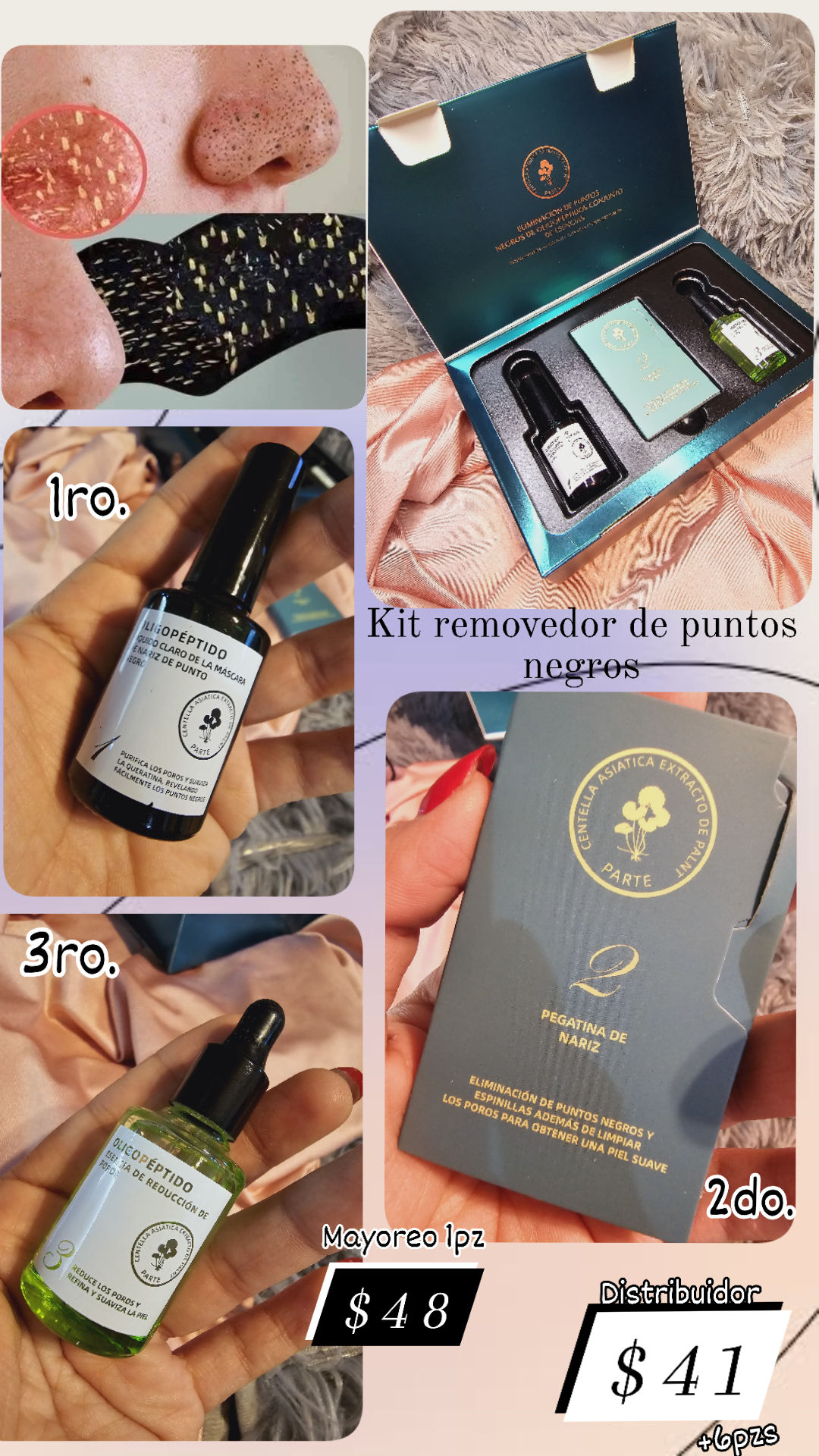 Grenobil set 3pasos. Puntos negros