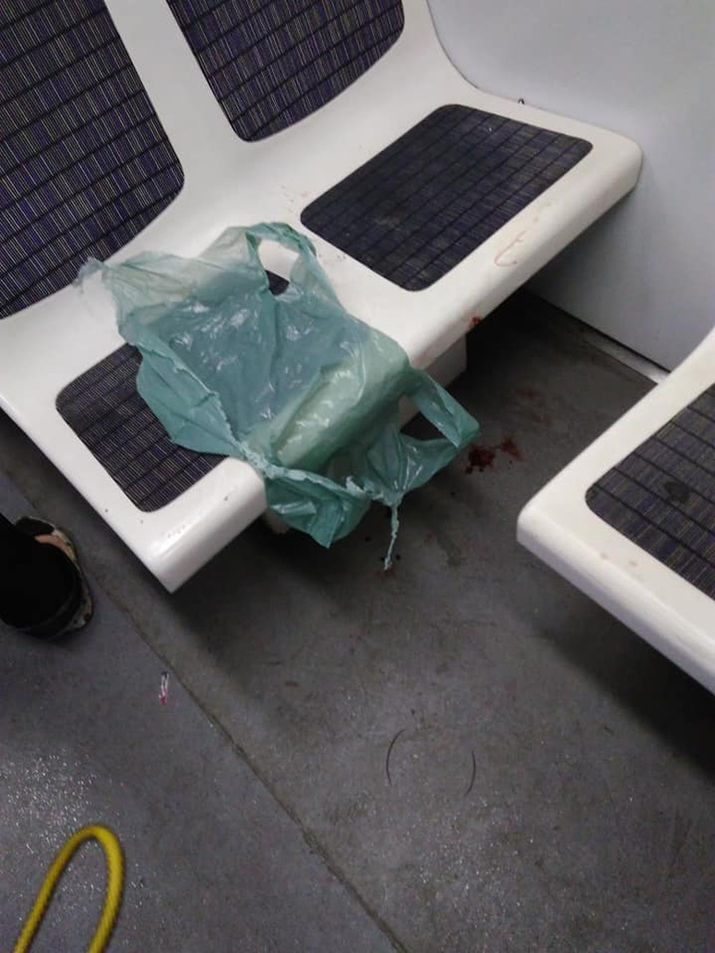 Jovem é atingido por bala perdida dentro do trem, em Paciência, Zona Oeste do Rio!