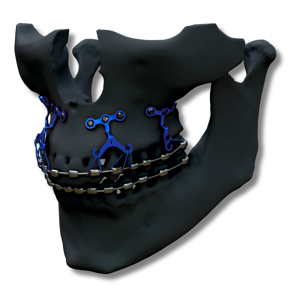 AncorFix.png