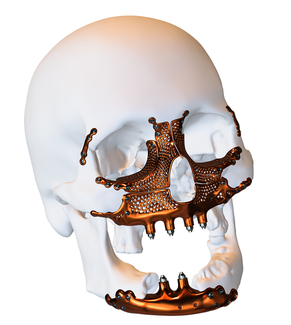 Reconstrução total - bronze_edited.png