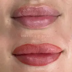 before after lip blush cosmetic tattoo result - Estetica Belle Pererenan, Bali