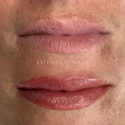 before after lip blush cosmetic tattoo result - Estetica Belle Pererenan, Bali