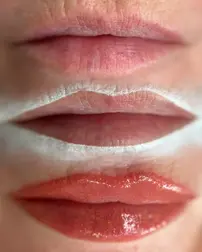 Lip Blush Before After Estetica Belle Pererenan, Bali