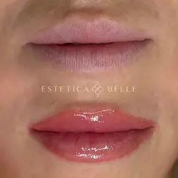before after lip blush cosmetic tattoo result - Estetica Belle Pererenan, Bali