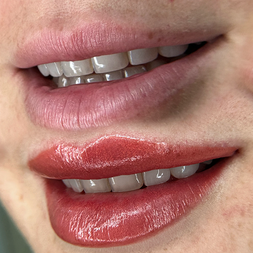 before after lip blush cosmetic tattoo result - Estetica Belle Pererenan, Bali