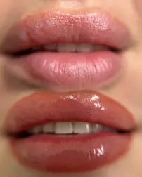 before after lip blush cosmetic tattoo result - Estetica Belle Pererenan, Bali