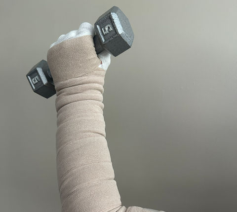 Lymphedema: Arm, Leg or Trunk