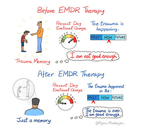 x15-EMDR-Therapy-Before-After-Small-750x750.jpg.pagespeed.ic.z9m6upysL5.jpg