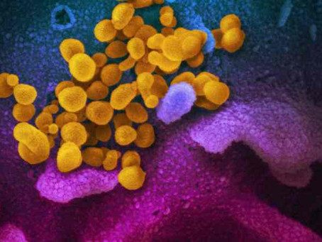 What does the hunt for a Covid-19 vaccine mean for the NWT?