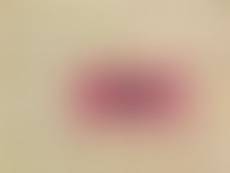 Is Hormone Replacement Therapy (HRT) Right for Me? A Complete Guide for Menopause Relief