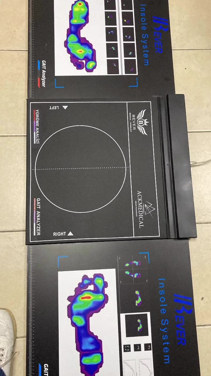 Küçük resim: Ayak Analiz Cihazı