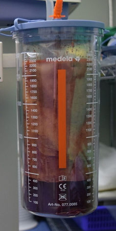 高雄抽脂 (3).jpg